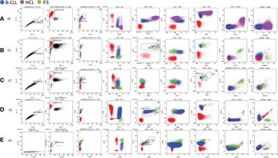 Case report: Hematologic malignancies concomitant diagnosis of hairy cell leukemia and chronic lymphocytic leukemia: A rare association